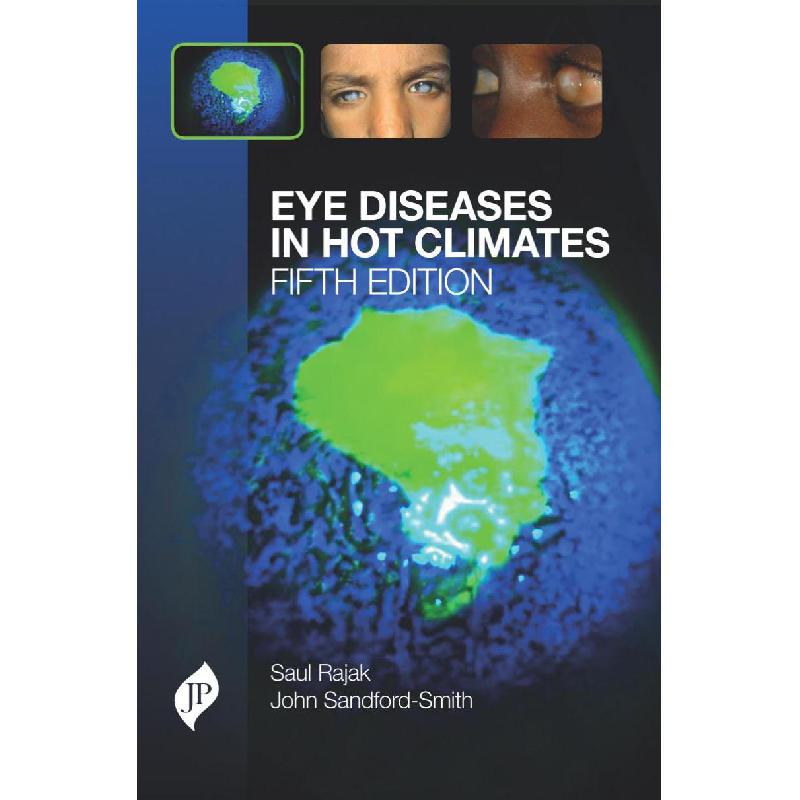 Eye Diseases in Hot Climates | الكتب الطبية | طب العيون | الكتب الانجليزية | أفضل العروض | الشحن الدولي