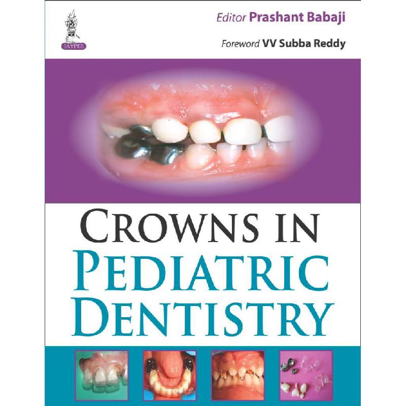 Crowns in Pediatric Dentistry | الكتب الطبية | الكتب الانجليزية | طب الأسنان | أفضل العروض | الشحن الدولي