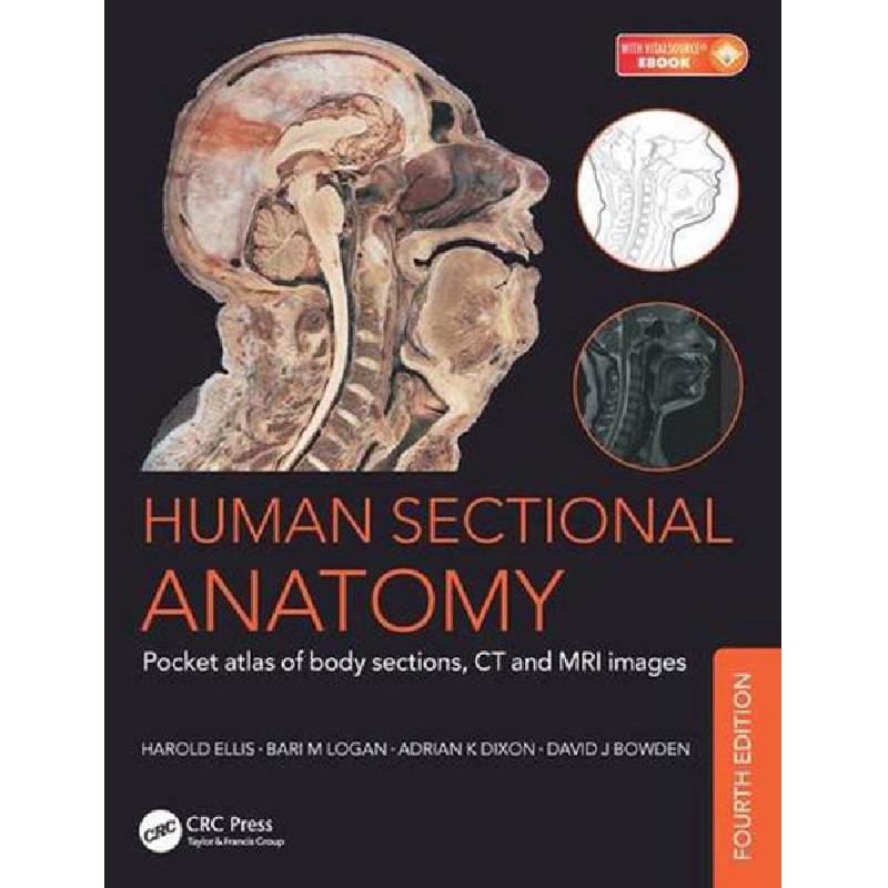 Human Sectional Anatomy | الكتب الطبية | التشريح / علم الأجنة / علم الأنسجة | الكتب الانجليزية | الشحن الدولي