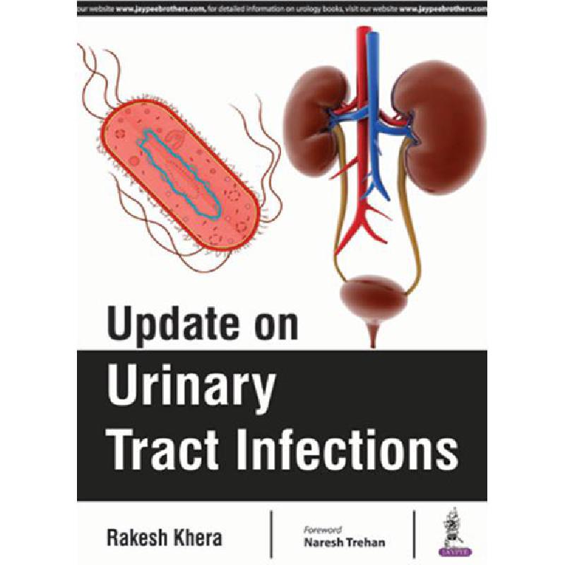 Update on Urinary Tract Infections | الكتب الانجليزية | الكتب الطبية | General Health | أفضل العروض | الشحن الدولي | عروض التصفية